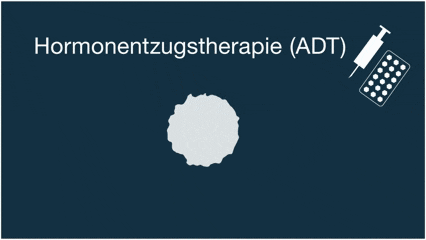 Hormonentzugstherapie (ADT) Erklärgrafik Hormonentzugstherapie